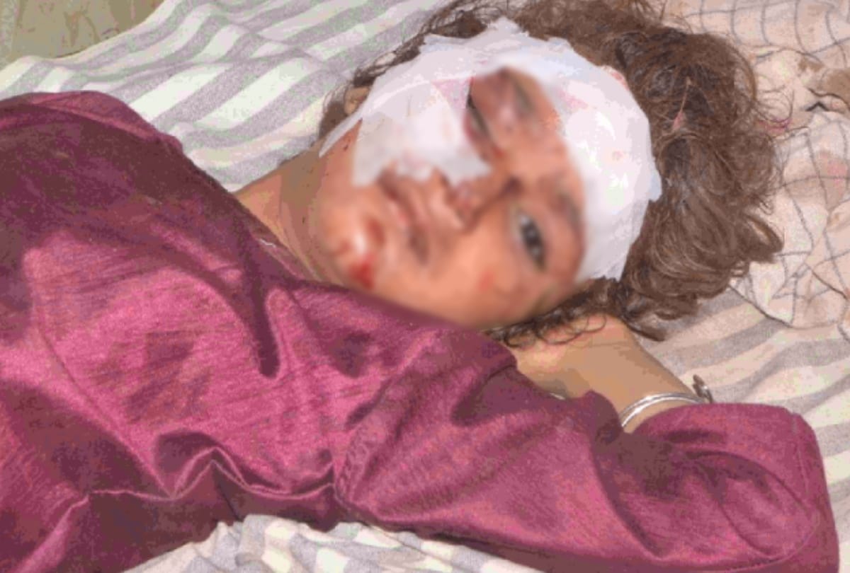 Hapur milk boiler blast 20 injured one girl dead see photos