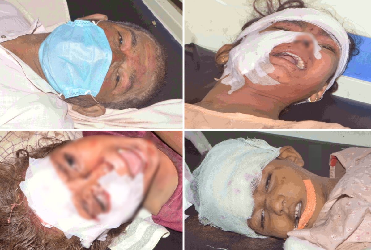 Hapur milk boiler blast 20 injured one girl dead see photos