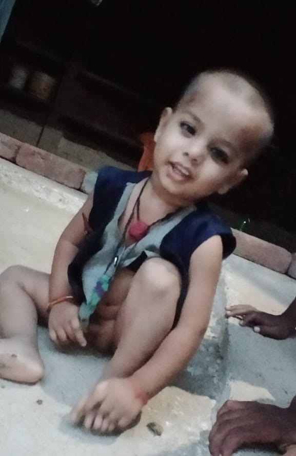 other