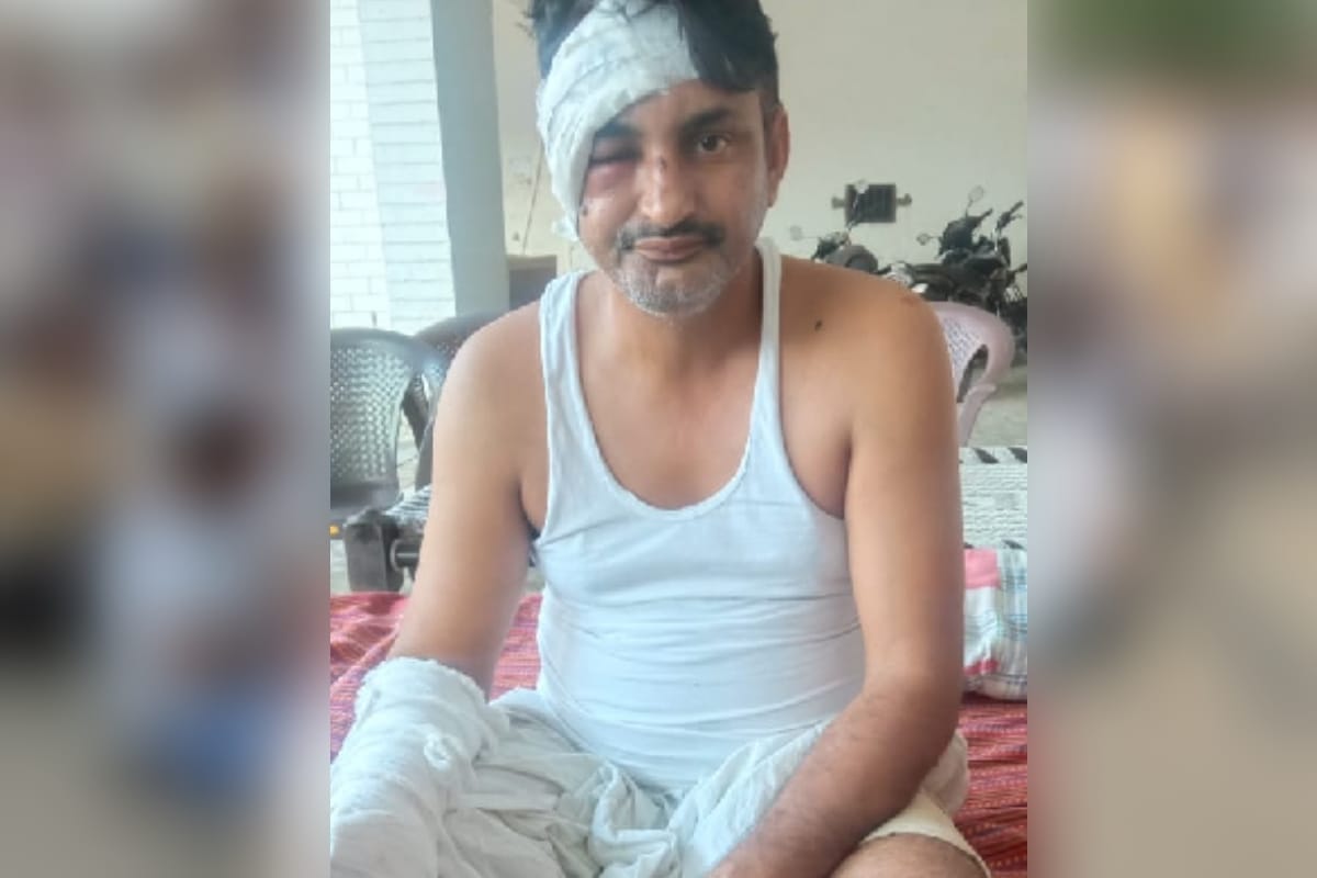 Bolero driving SP leader dragged far into the road, injured, accused absconding