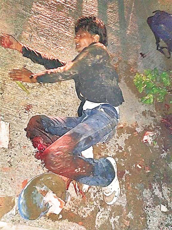 Crook injured in firing