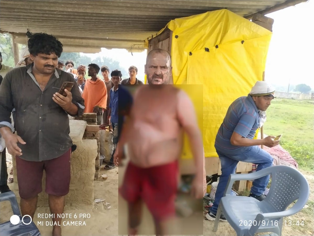truck driver who was burnt by the finance staff by spraying petrol died during treatment