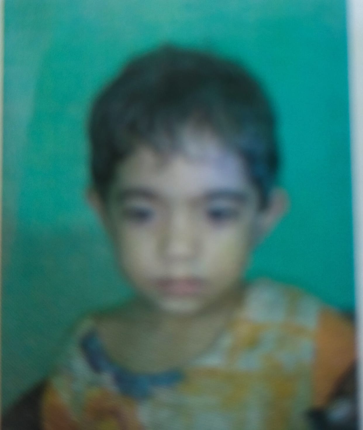 Scorched girl dies during treatment