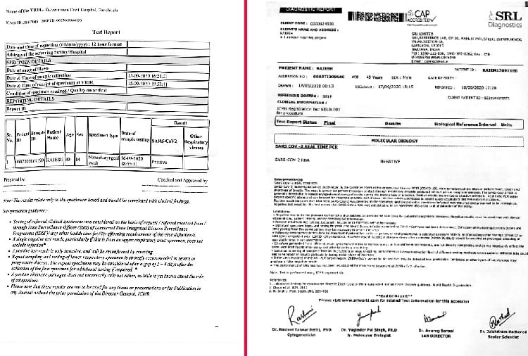 Chandigarh News in Hindi: Two labs gave separate test report of corona patient