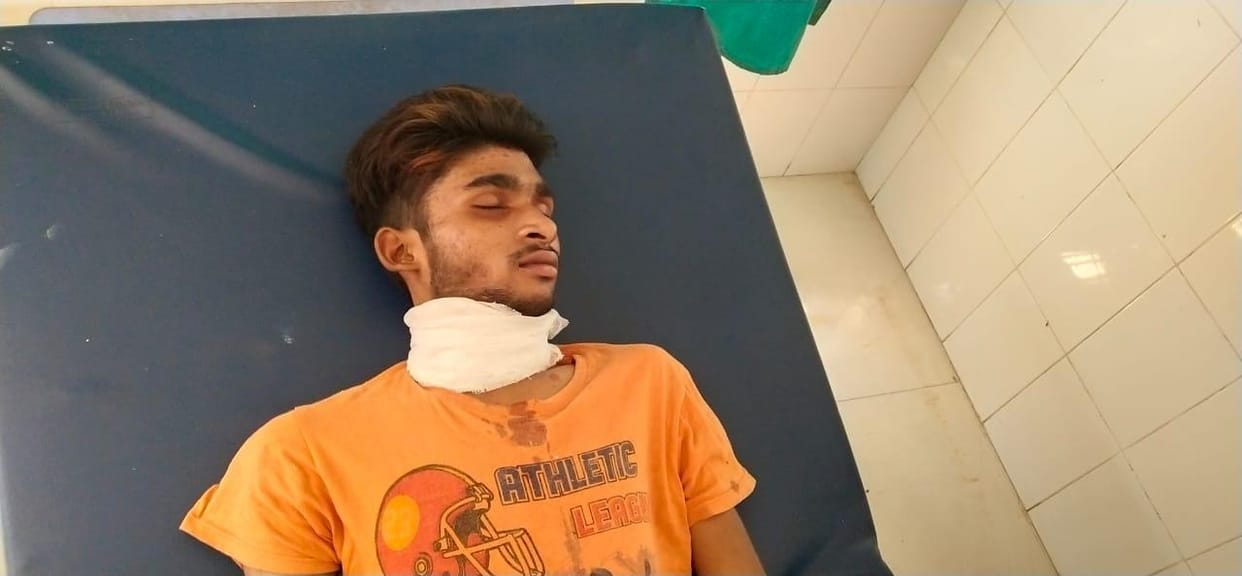 Accused of rape and POSCO Act in Jalaun, injured in temporary jail