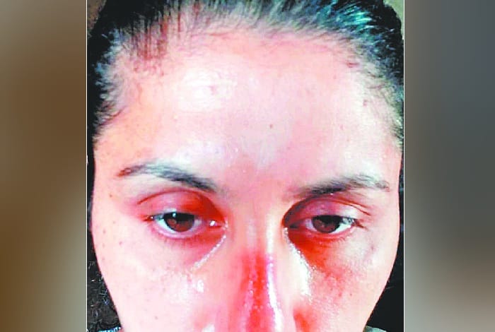 Corona Warriors Story May Encourage You to Fight With Corona Pandemic