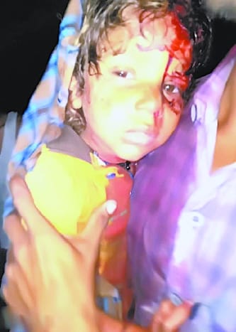 Pankhia gang attack in eastern, mother-daughter injured in firing