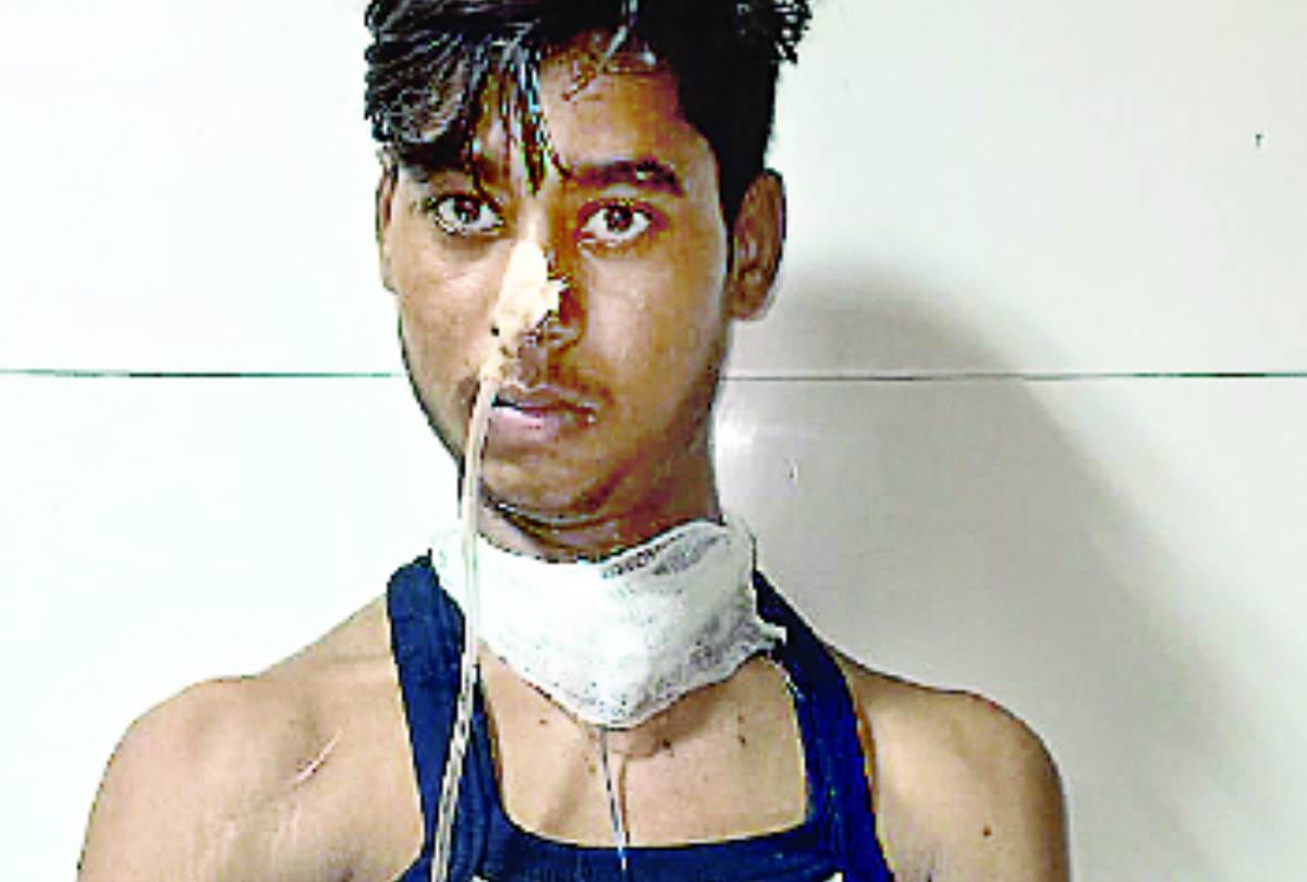 doctors of KGMU trauma center saved lives of patient