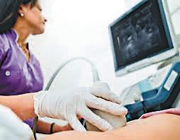 How will ultrasound be done after the retirement of CMS