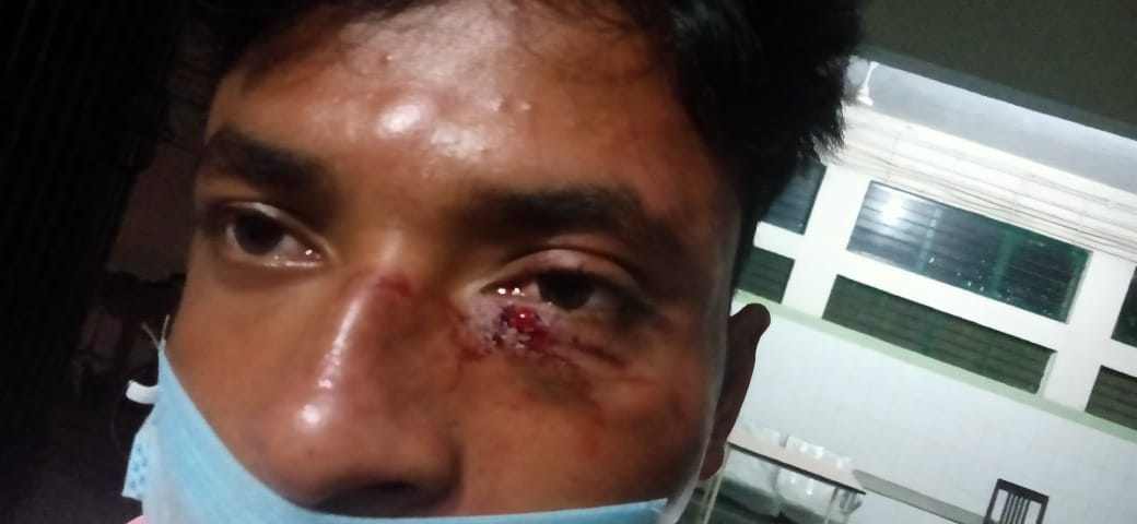 Youth attacked due to rivalry