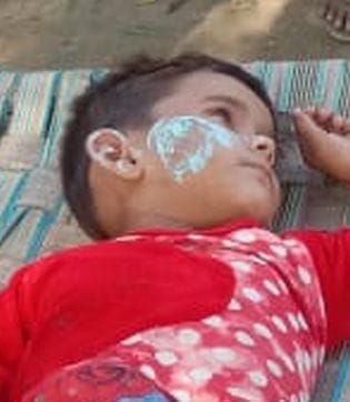 Ashes from fire in a hut, father and daughter scorched
