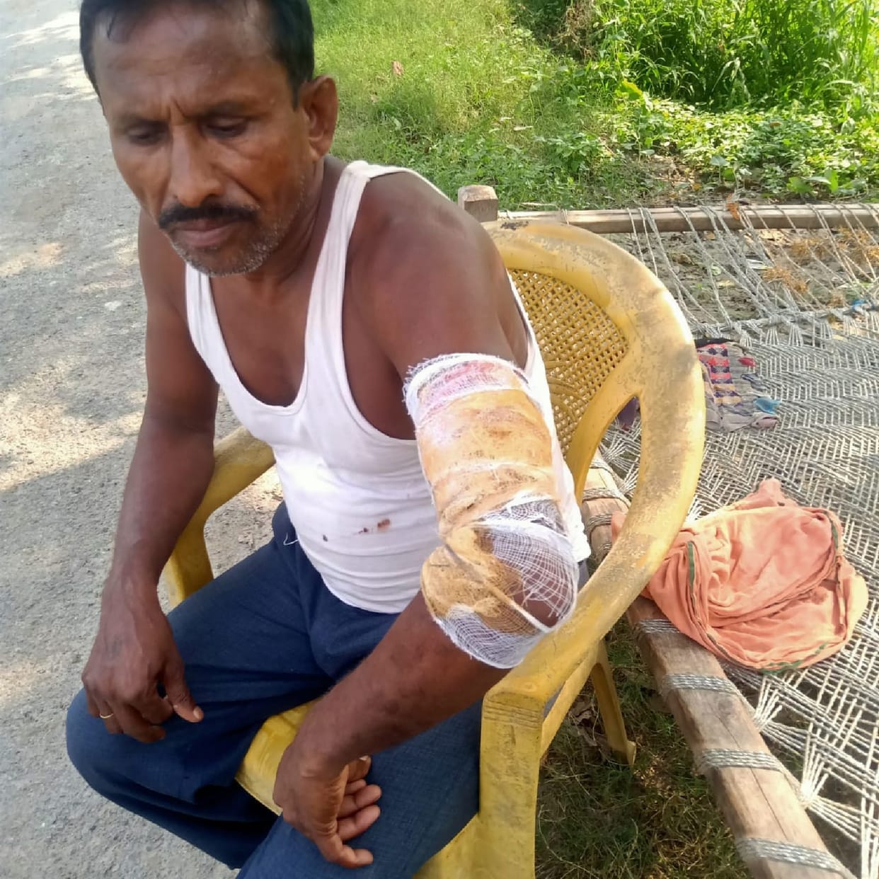 Young man clashed with leopard to save his life