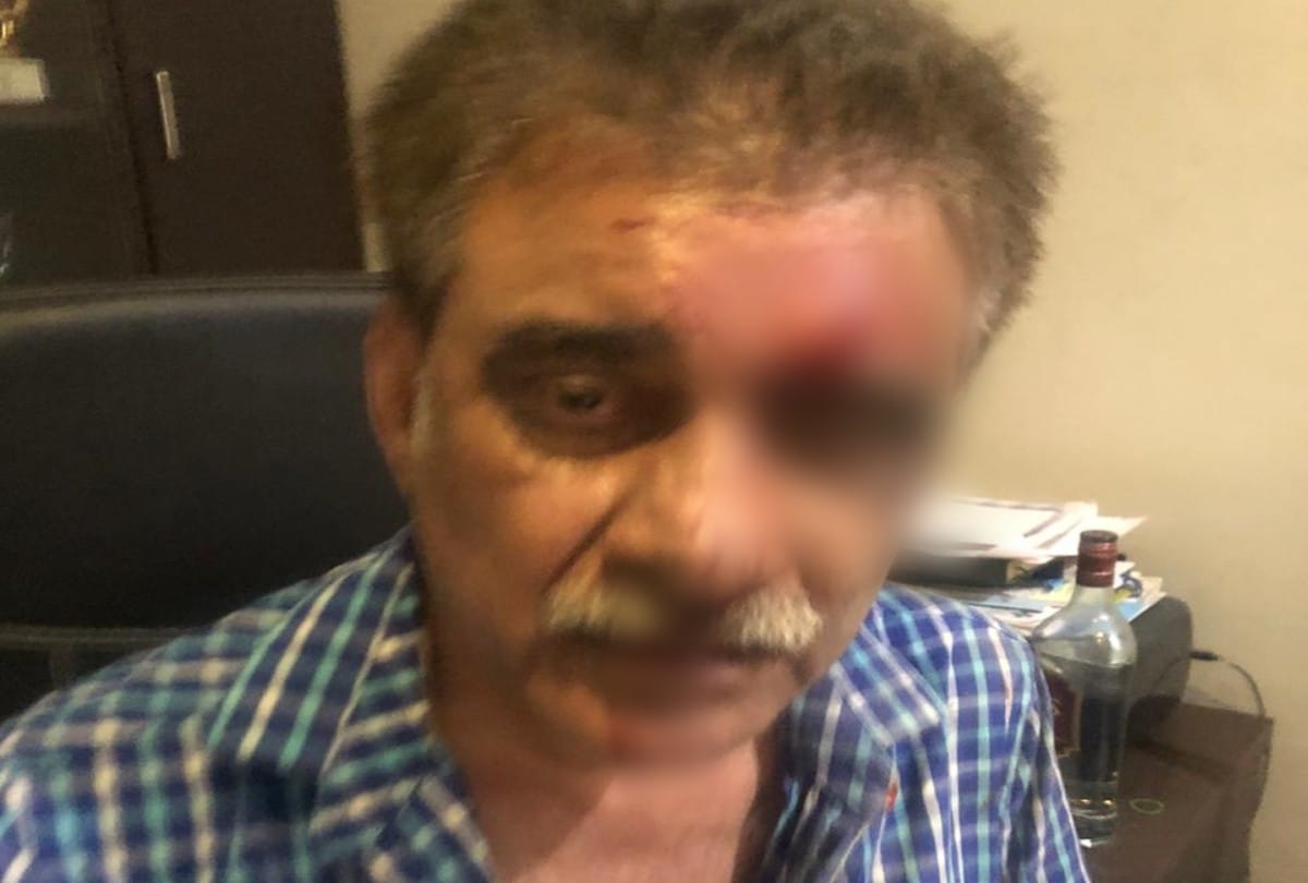 Two doctors clashed in car parking dispute in agra
