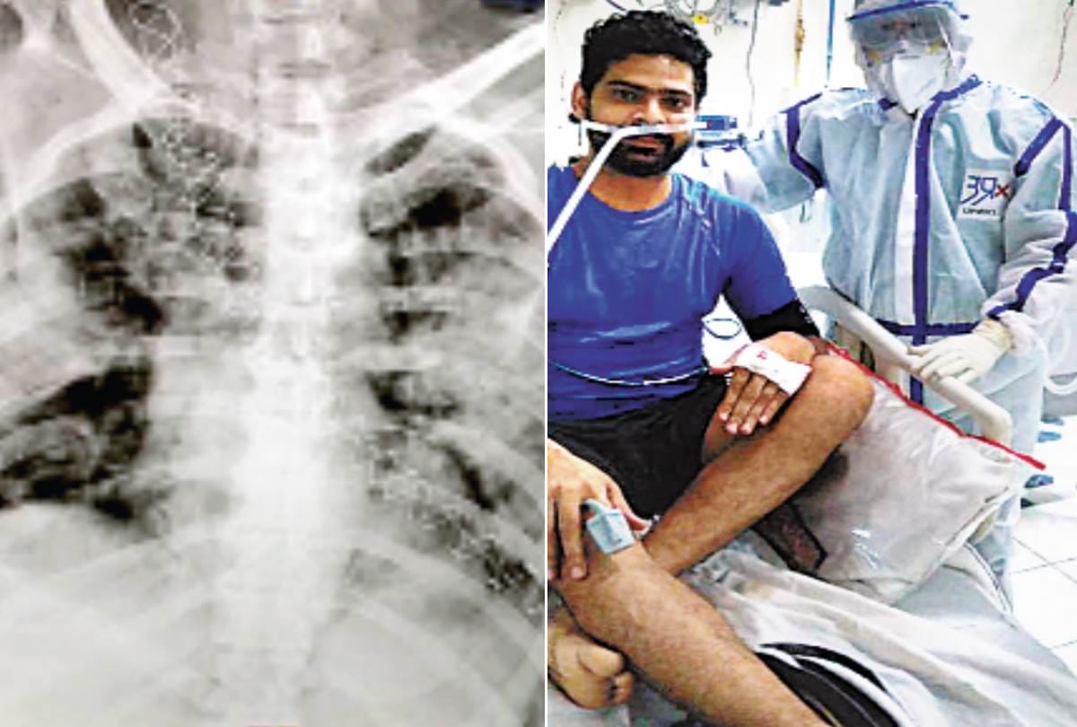 prone ventilation is good for corona patients