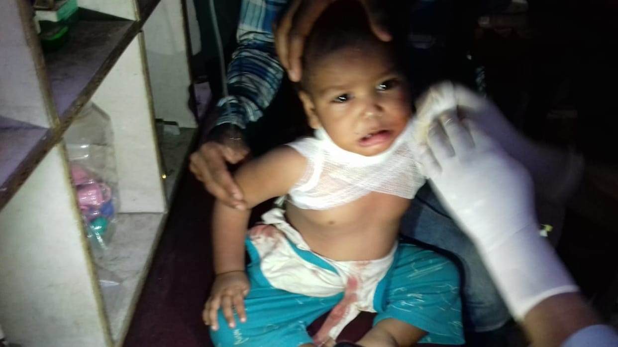 child stangled to china kite string in sambhal