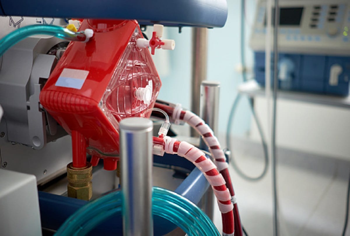 coronavirus ecmo machine also saved thousands of lives in the world Apart from ventilator