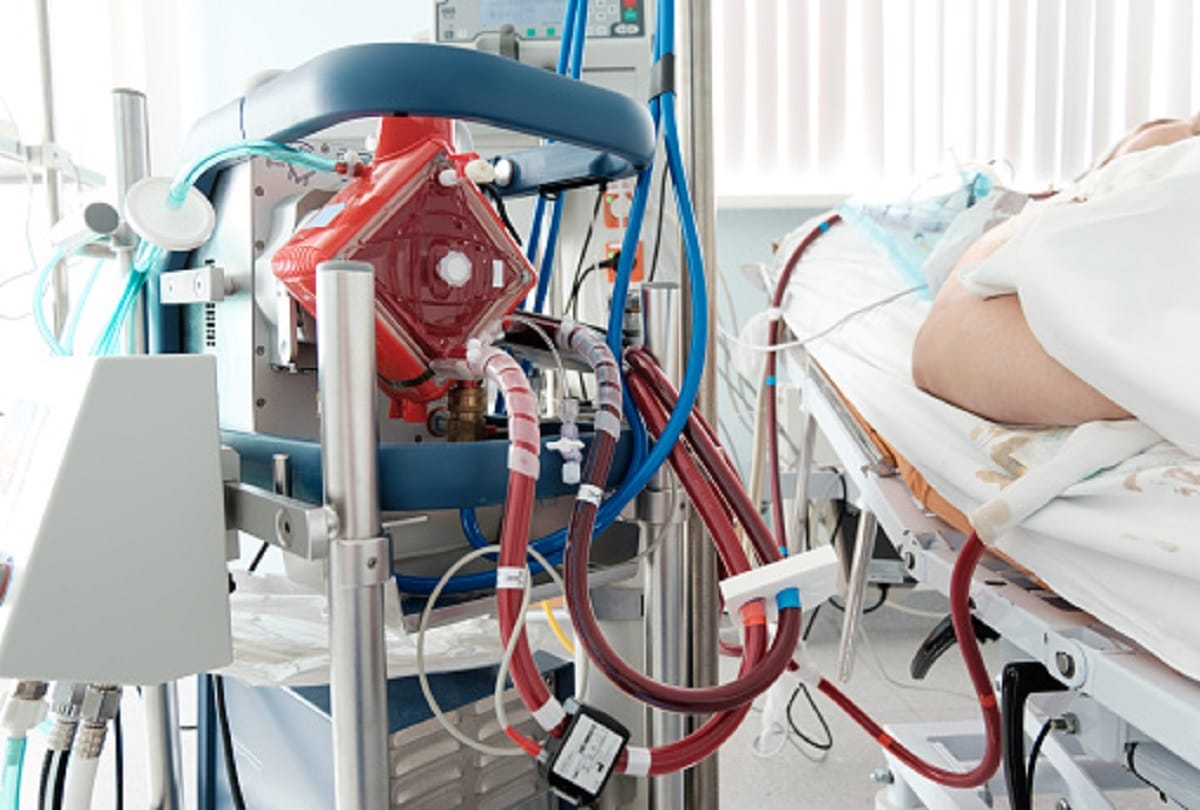 coronavirus ecmo machine also saved thousands of lives in the world Apart from ventilator