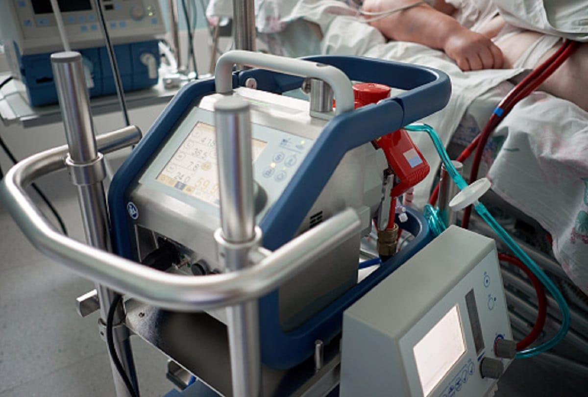 coronavirus ecmo machine also saved thousands of lives in the world Apart from ventilator