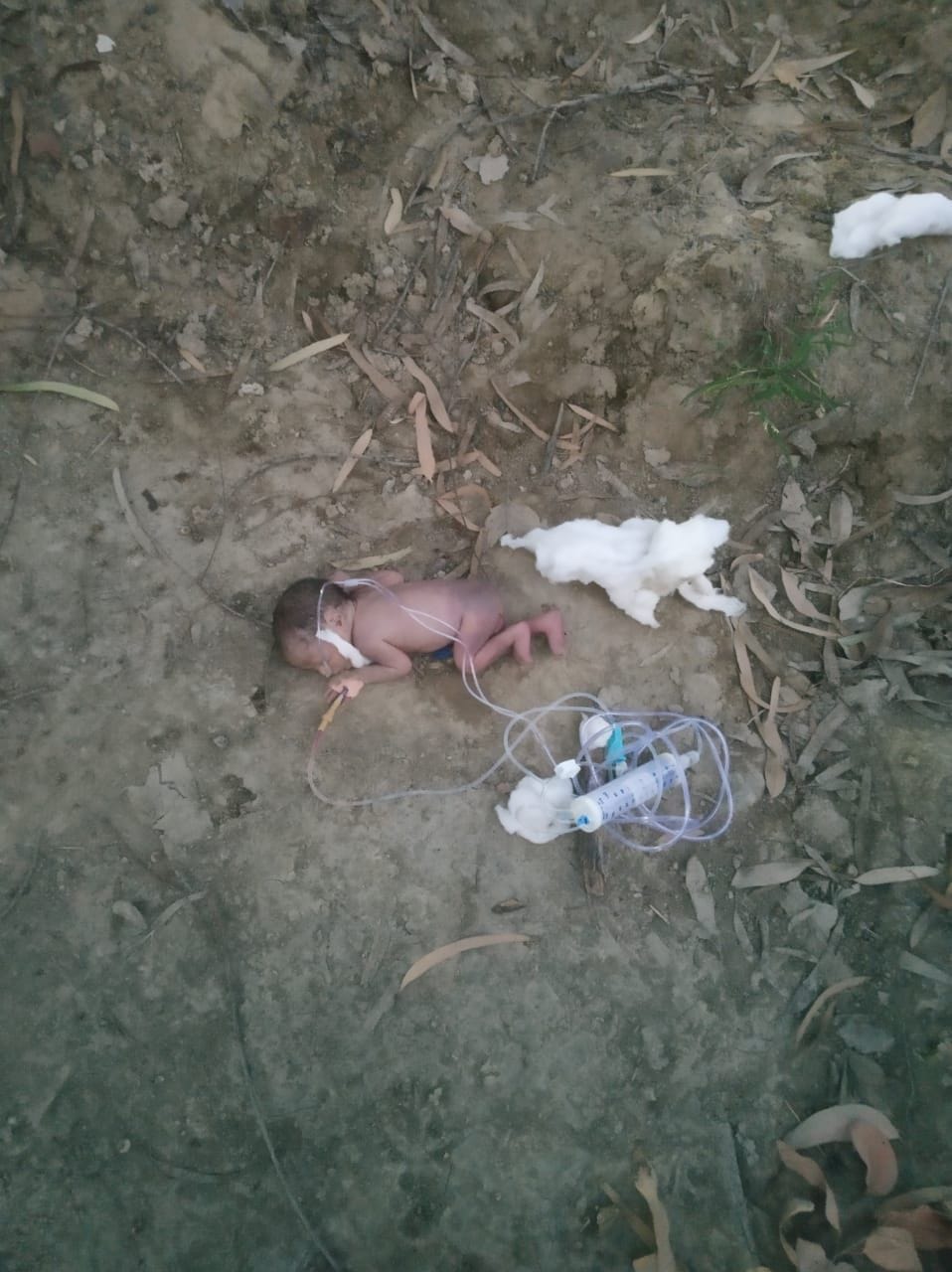 A day old newborn was left to die, the guards saved