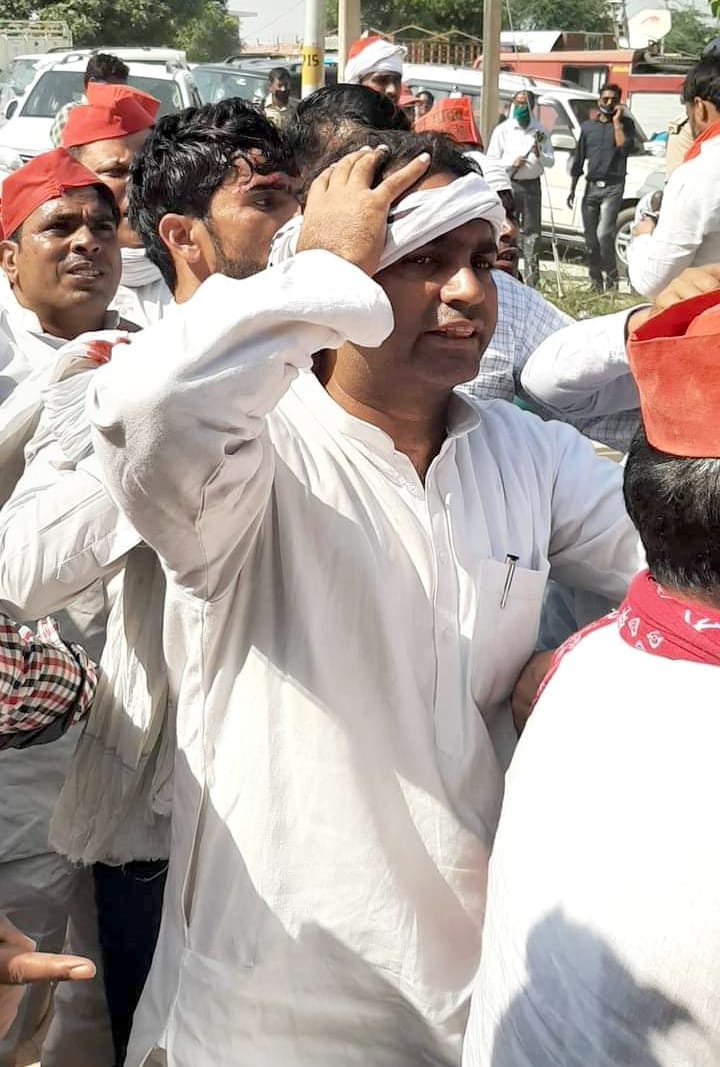 District leaders also injured in lathicharge in Hathras