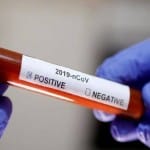 coronavirus in uttarakhand latest news : 420 positive case found today