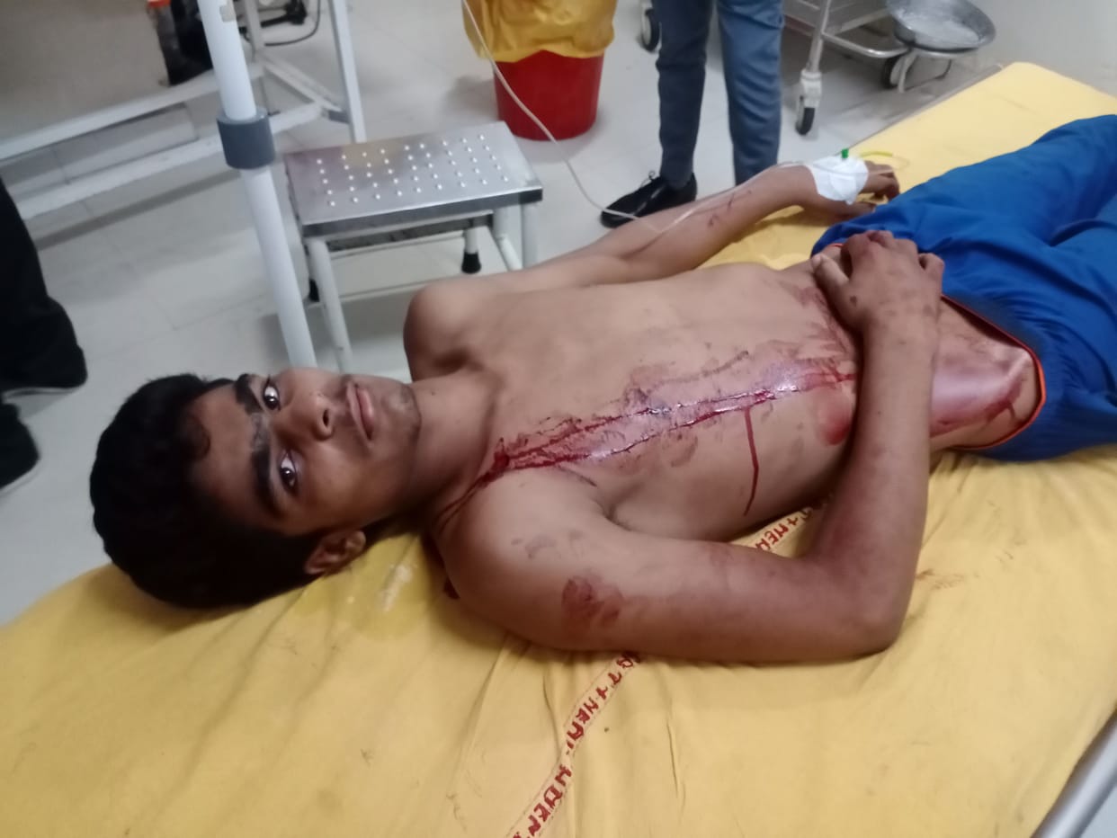 hotel honour, father and son, shoot, injured