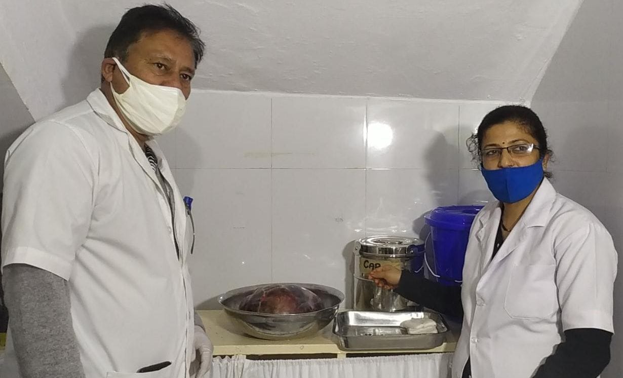 Five and a half kilogram tumor removed from woman's abdomen, team of doctors performed successful operation at BD Pandey Hospital