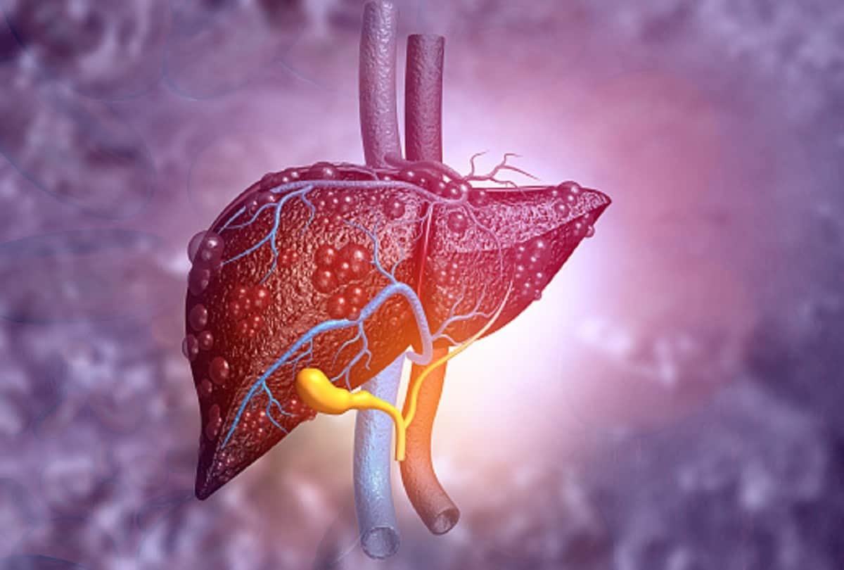 World Liver Day Alcohol cigarettes and obesity causing liver damage