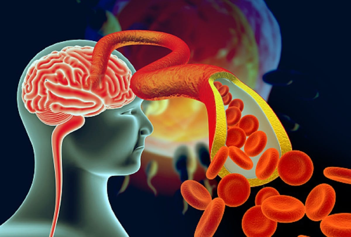 Coronavirus signs and symptoms of blood clotting in the body