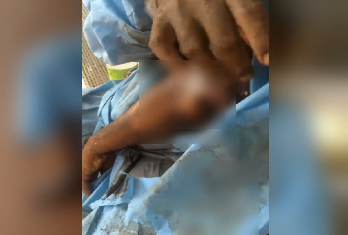 Delhi ram manohar lohia hospital send back patient whose legs had worms hands were badly injured now NGO getting him treated