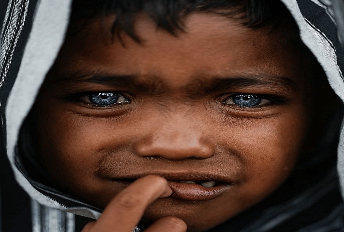 most stunning blue eyes of indonesian indigenous tribes due to waardenburg syndrome