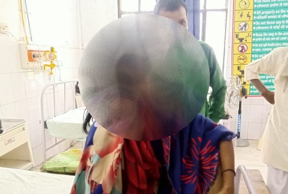 Gonda UP News: Acid attack on sisters in Gonda.