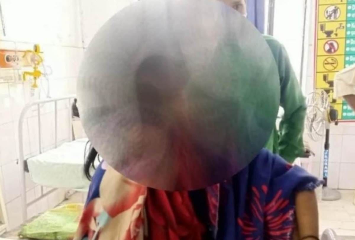 know about the story of acid attack survivor in gonda