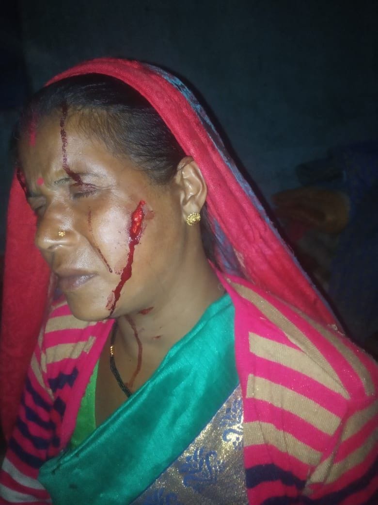 Leopard pounces on woman returning home, injury on woman's face