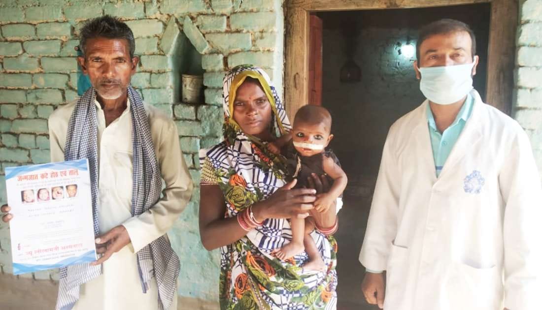 Free surgery on severed lips returned innocent smile