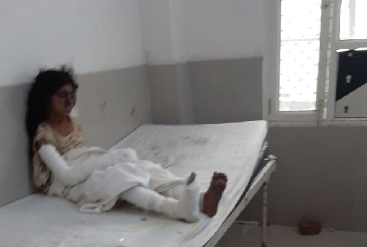 cracker factory blast 13 year old brother saved his sister's life in agra