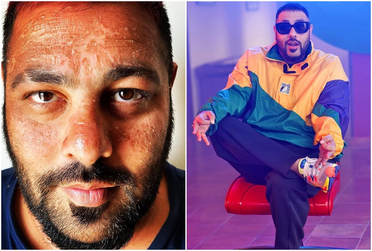 Bollywood Singer Badshah Gets Sunburn While Holidays In Maldives Varun Dhawan Reacted and Said Same