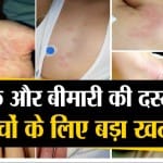 कावासाकी
