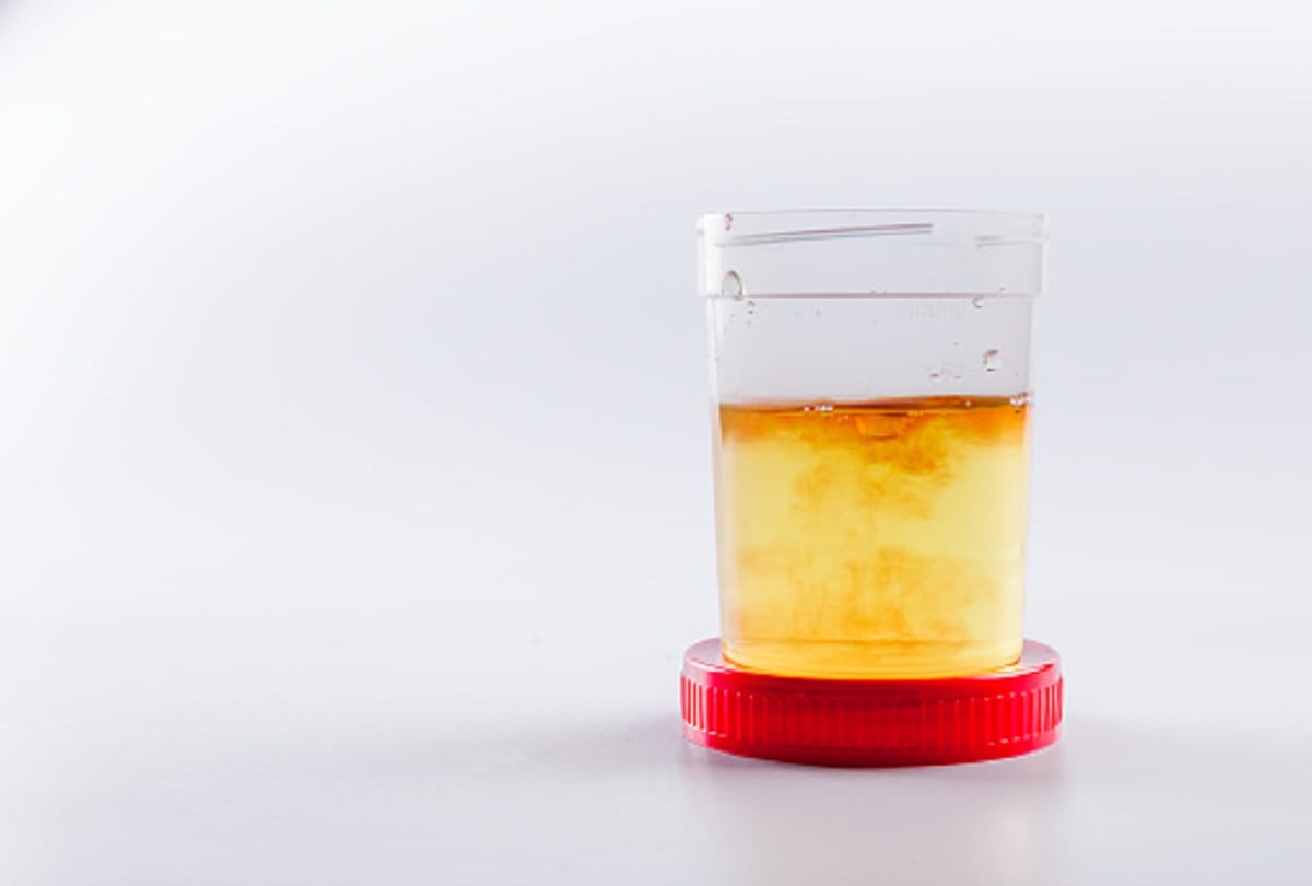 Ancient Roman people used urine for washing mouth and clothes