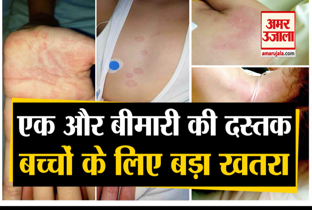 कावासाकी