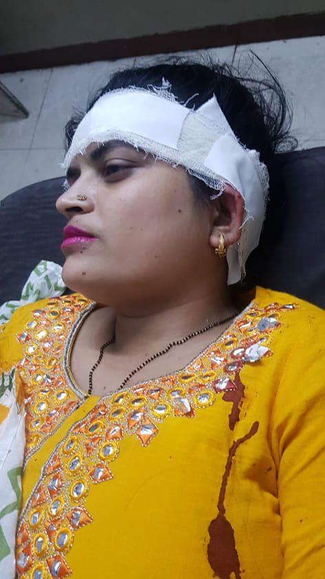 Heavy stone thrown on moving car, woman injured
