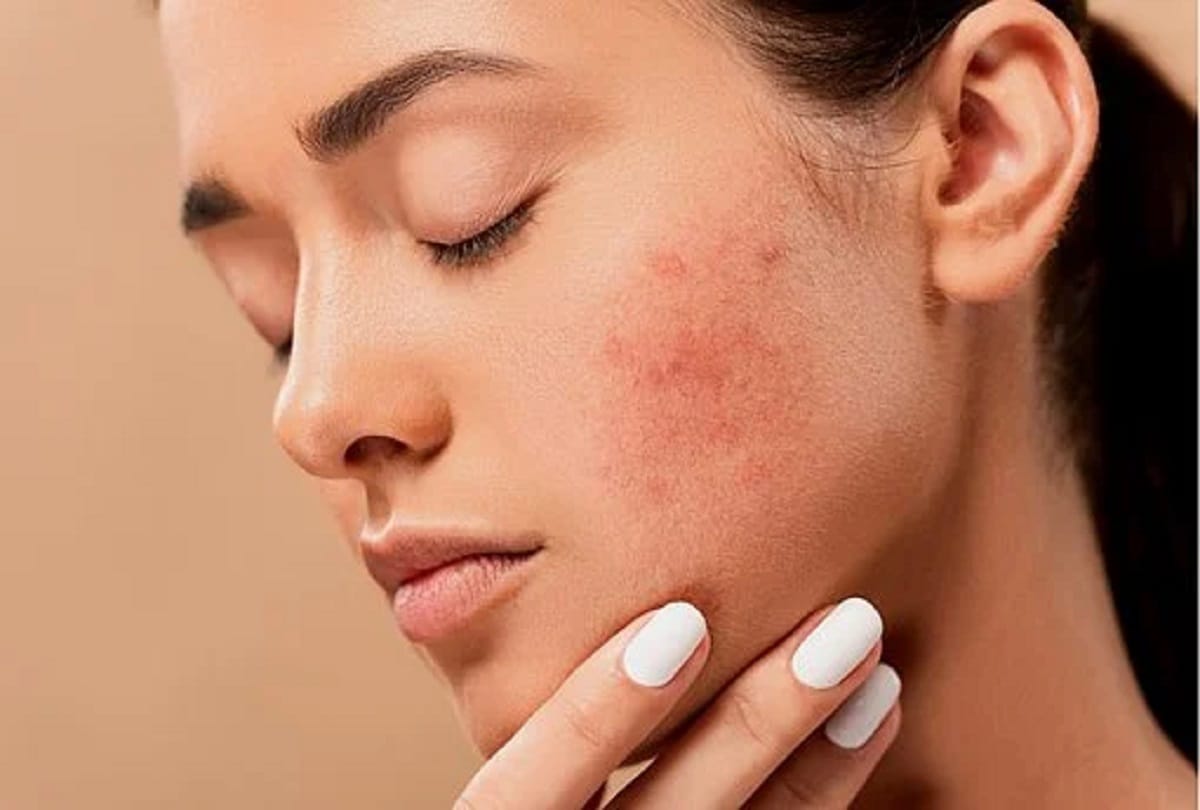 Skin Care how to use pomegranate peel for skin care in hindi