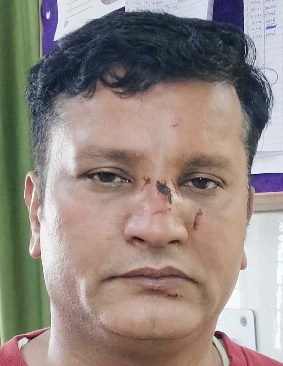 Son of ex-principal couple arrested for ax attack