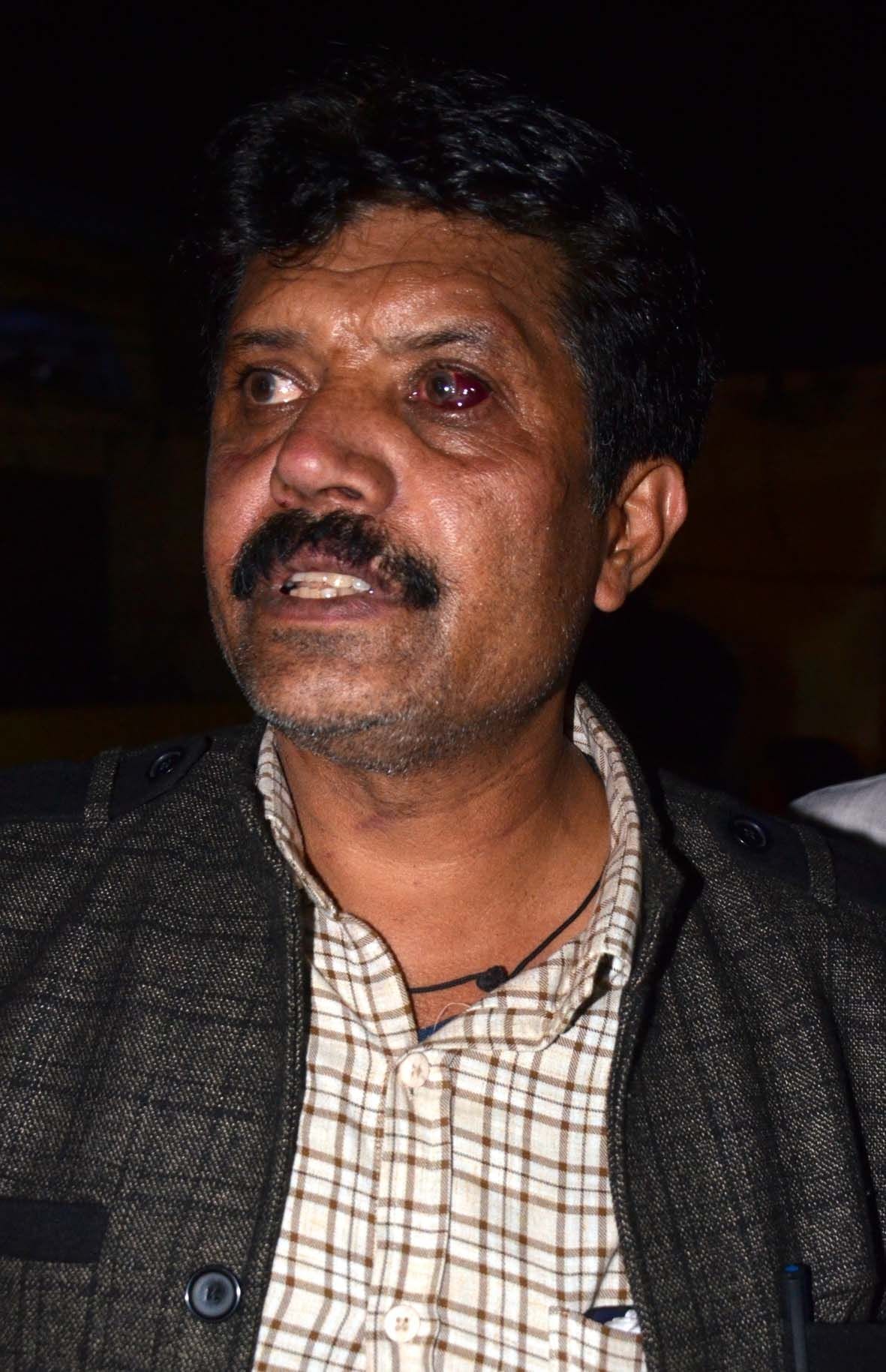 SP leader Prashant Valmiki was beaten