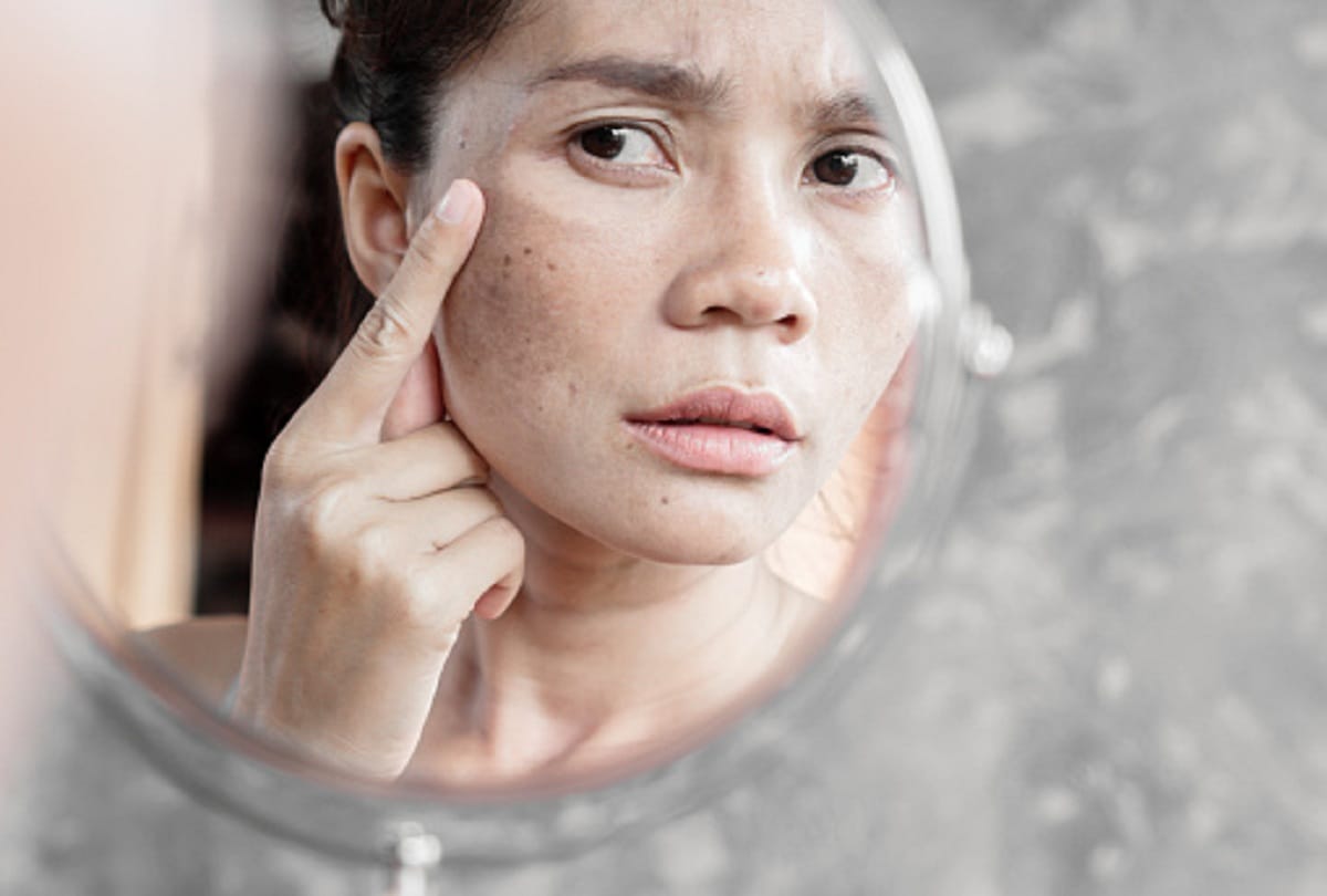 These home remedies will improve the dry face