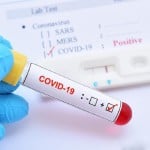 prayagraj news : Covid - 19