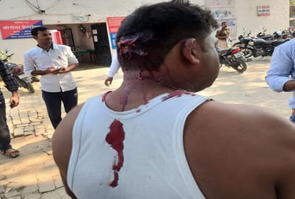 In Soraon, miscreants Shoot young man, SRN referred