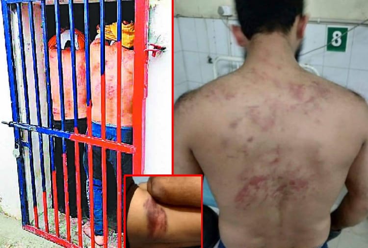 Allegation of third degree torture on Ludhiana police