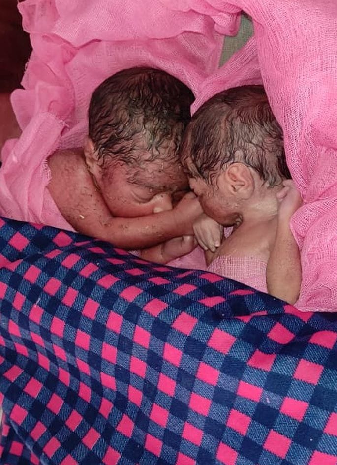 baik savaar prasoota ne raaste mein teen bachchon ko diya janm