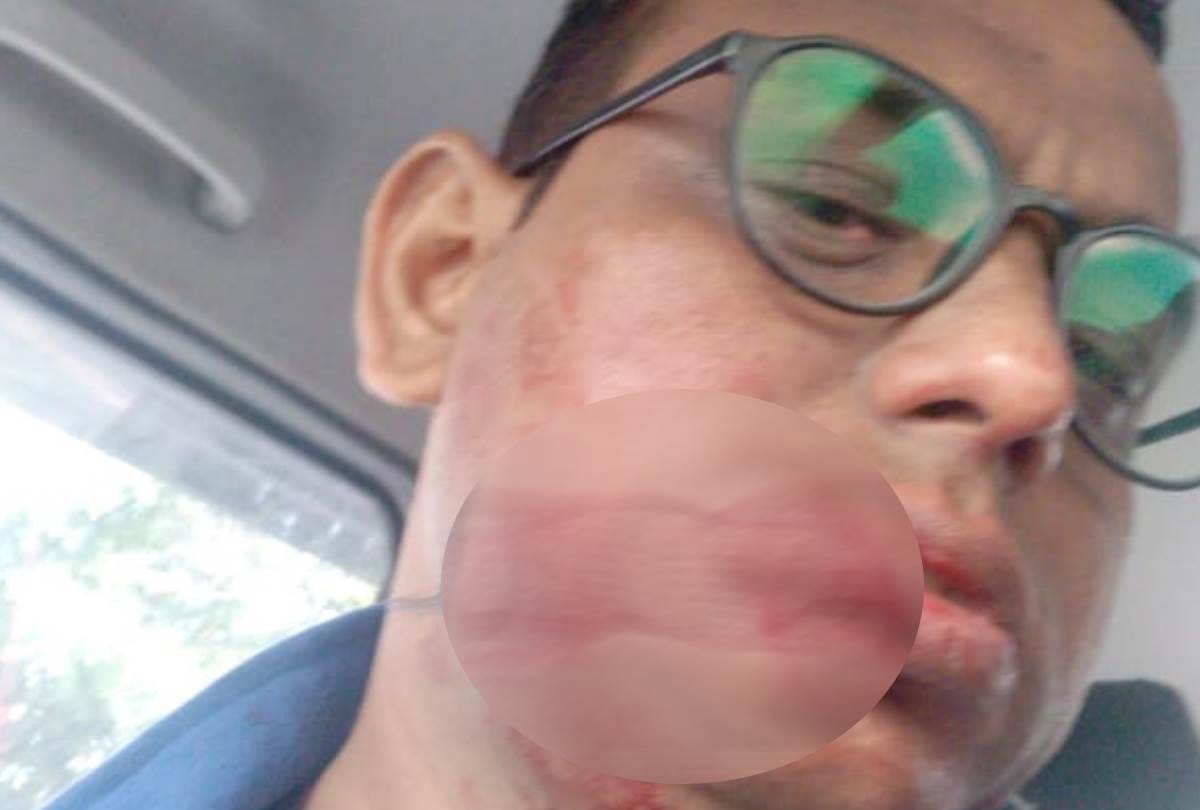 man Injured due to manjha in lucknow